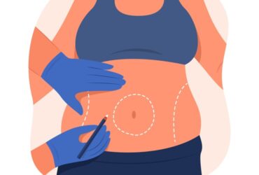 تكلفة عملية تحويل المسار