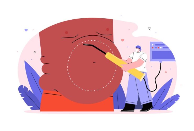 أرخص عملية تكميم في مصر