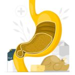 عملية تحويل المسار