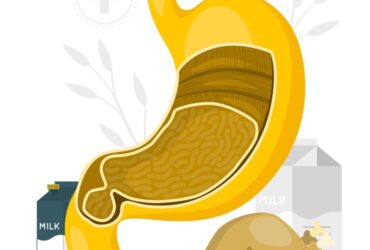 عملية تحويل المسار